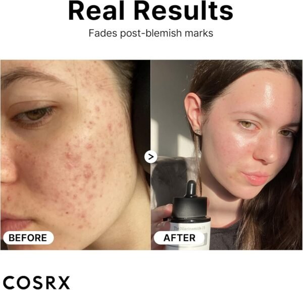 61-iyOhySqL._AC_SL1500_ COSRX Niacinamide 15% Face Serum 20ml Minimizing Pores & Sebums, Blemish Treatments for Discoloration, Dark Spots, Enlarged Pores, Anti-aging