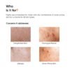 61QLKY4VNFL._SL1080_ Minimalist Vitamin B5 10% Moisturizer 50g | Minimalist Dehydrated Skin & Damaged Barrier Repair Moisturizer with 10% Vitamin B5 | Oil-Free Hydration & Lightweight Gel Formula | Fast-Absorbing & Non-Sticky Lightweight Winter Cream For Women & Men | Fragran