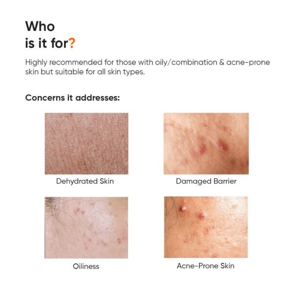 61QLKY4VNFL._SL1080_ Minimalist Vitamin B5 10% Moisturizer 50g | Minimalist Dehydrated Skin & Damaged Barrier Repair Moisturizer with 10% Vitamin B5 | Oil-Free Hydration & Lightweight Gel Formula | Fast-Absorbing & Non-Sticky Lightweight Winter Cream For Women & Men | Fragran